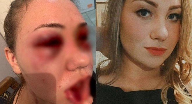 Homem agride mulher por ciúmes 