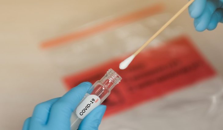 Julho tem queda de mais de 50% de casos Covid19 e óbitos com relação a junho