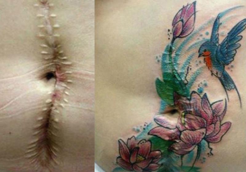 Mulher faz tatuagens gratuitas em vítimas de agressão doméstica