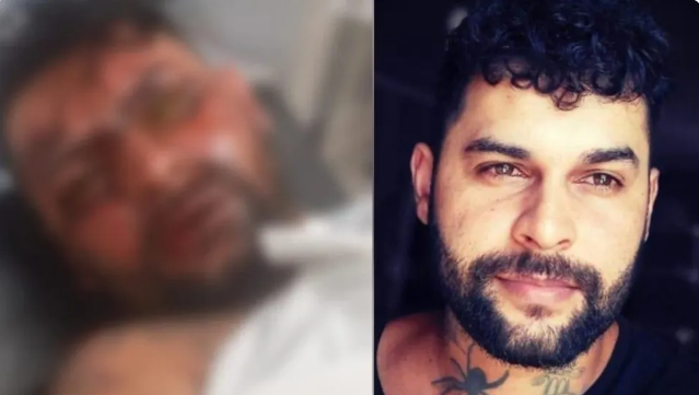 Tatuador que ficou cego com soda cáustica jogada no rosto pela ex perde olho após transplante.