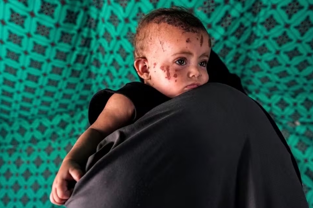 Bebê de 3 meses é a única sobrevivente de bombardeio que matou família em Gaza