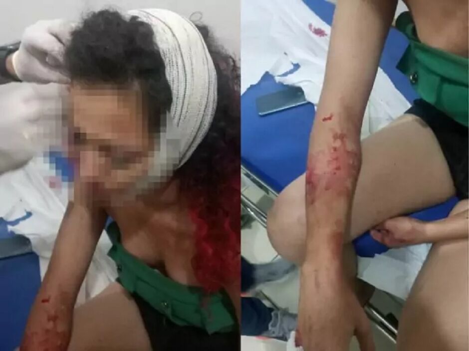 Mulher é agredida com tijoladas na cabeça pelo ex que não aceita fim do namoro em MS