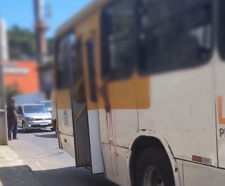 Passageira faz selfie em ônibus e tem braço arrancado por poste