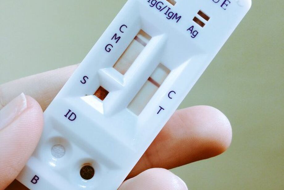 MS terá teste rápido inédito para diagnóstico de dengue na rede pública 