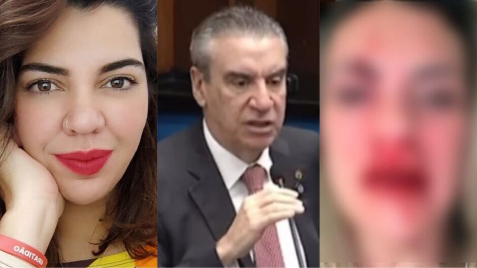 Deputado repudia atendimento a sobrinha agredida por músico e diz: 'mesma delegada do caso Vanessa' 