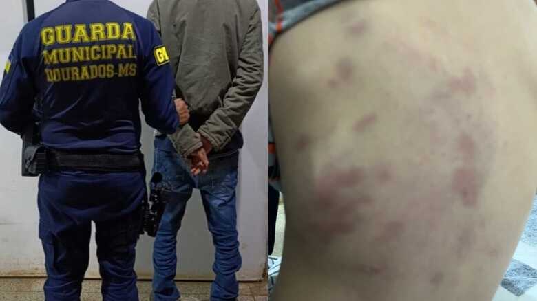 Prefeitura diz que menino agredido pelo padrasto está matriculado em Ceim