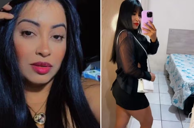 Mulher morre após passar por preenchimento estético com hidrogel