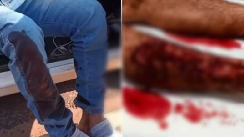 Idoso sobe em árvore para fugir de ataque de cachorros em MS