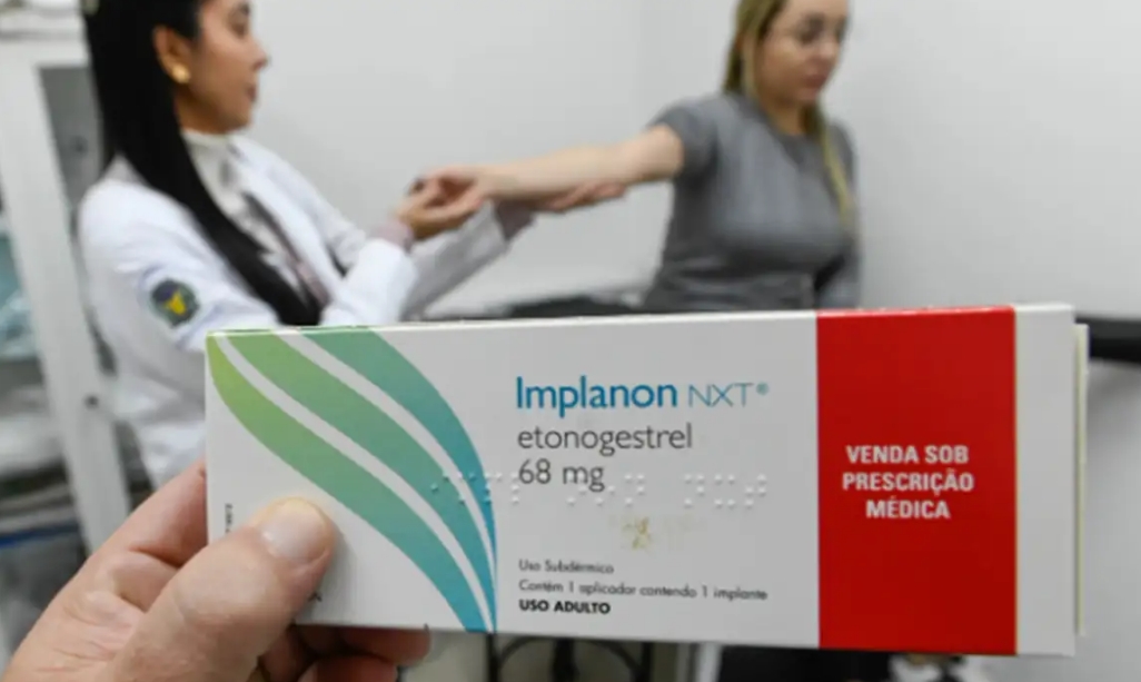Brasil recebe mais de 100 mil implantes contraceptivos Implanon