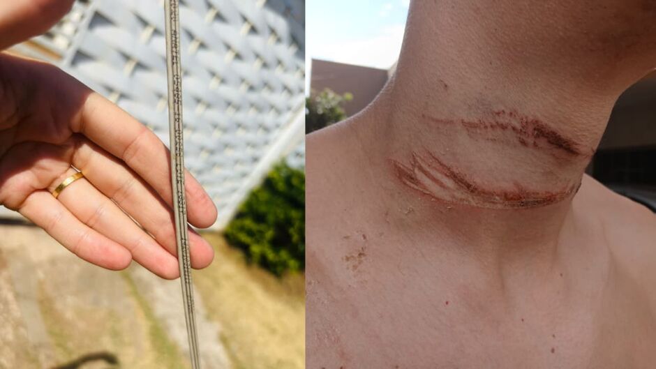 Jovem quase é degolado por fio solto enquanto pilotava moto em MS
