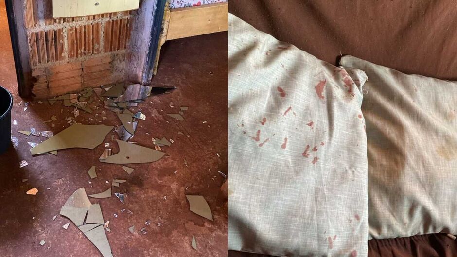 Mulher que matou companheira já havia quebrado braço da vítima 
