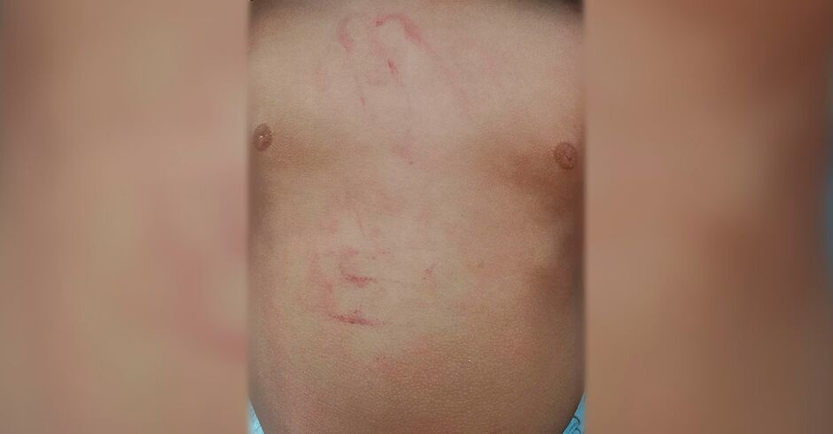 Mãe denuncia babá por agredir bebê de 1 ano e 5 meses em MS 
