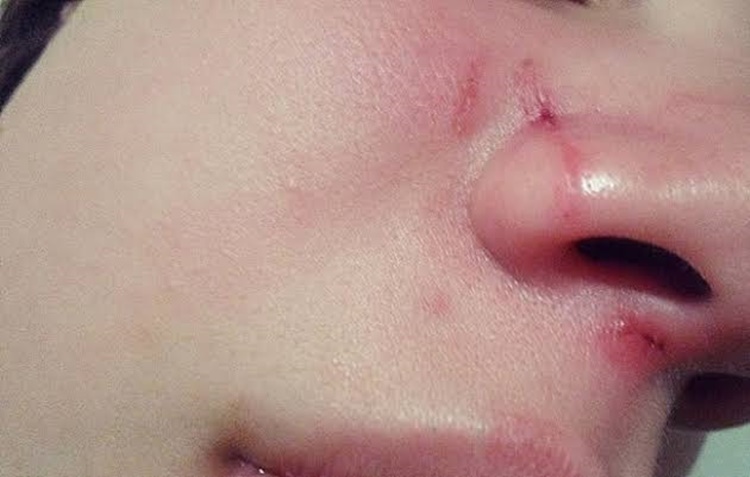 “Você não me conhece ainda”: jovem é agredida pela ex do namorado em festa de aniversário