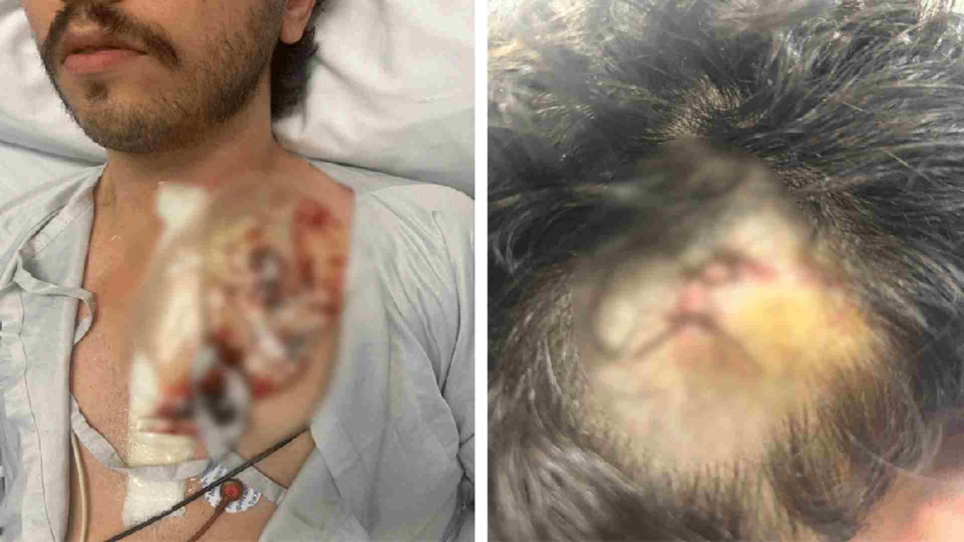 Médico e advogado são vítimas de esfaqueamento na Rua da Consolação