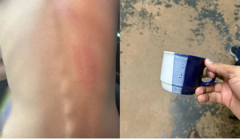 Criança é agredida com xícara por aluno mais velho em colégio de Campo Grande