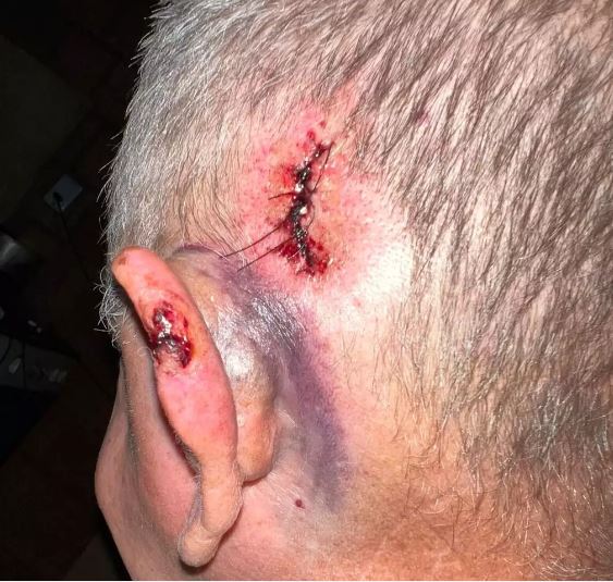 Idoso é agredido por grupo durante tentativa de assalto em Campo Grande