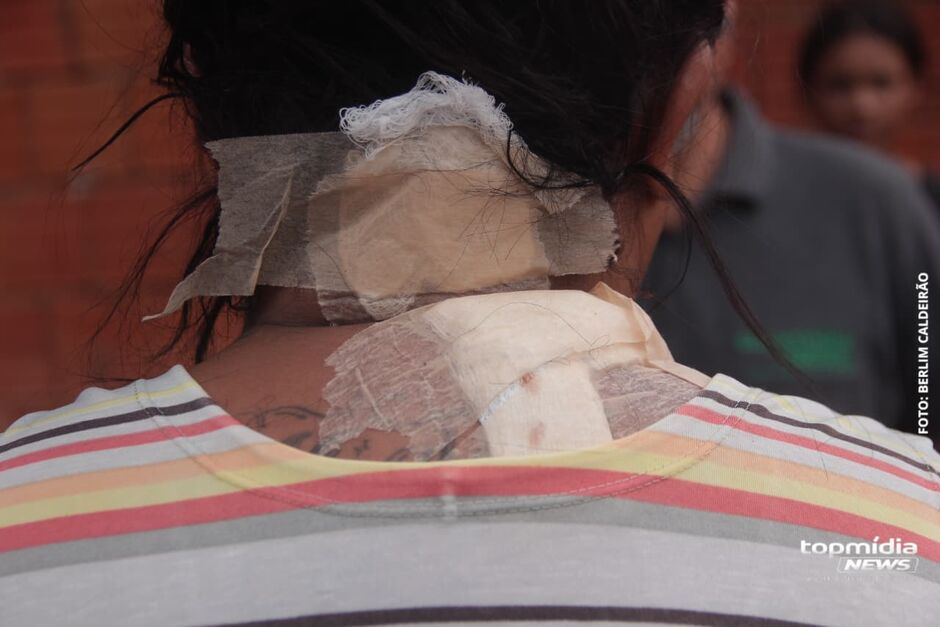 Mulher é ferida no pescoço pelo marido em Dourados