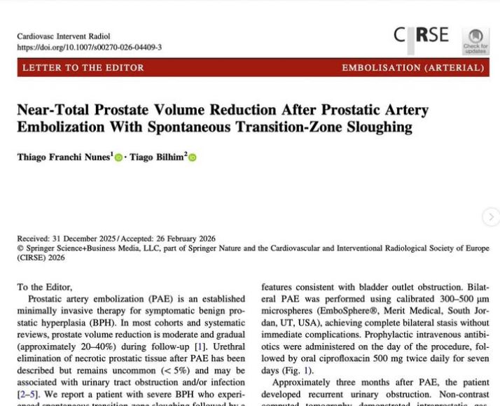 Embolização da próstata surge como alternativa minimamente invasiva para tratamento da HPB