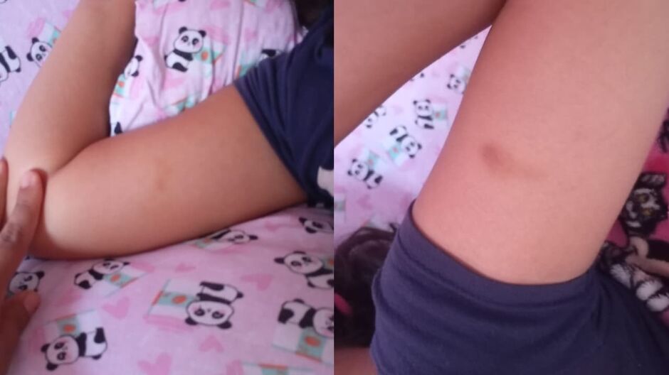 Mãe denuncia agressão contra filha dentro de escola em Campo Grande
